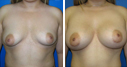 Before & After Photos